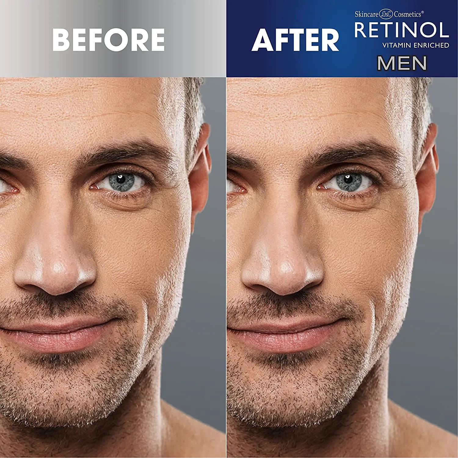 Retinol Mens Charcoal Peel Off Nose Strips